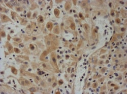 TIMP-3 Antibody, Novus Biologicals 0.2mg:Antibodies, Polyclonal